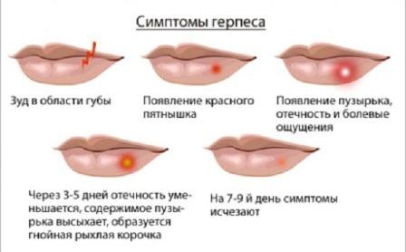 gerpes